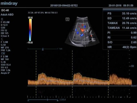 Аппарат ультразвуковой диагностический DC-40 - 415 000 руб.