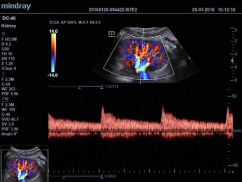 Аппарат ультразвуковой диагностический DC-40 - 415 000 руб.