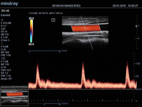 Аппарат ультразвуковой диагностический DC-40 - 415 000 руб.