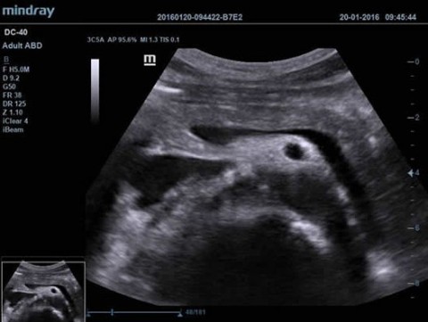 Аппарат ультразвуковой диагностический DC-40 - 415 000 руб.