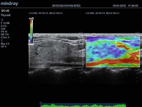 Аппарат ультразвуковой диагностический DC-40 - 415 000 руб.