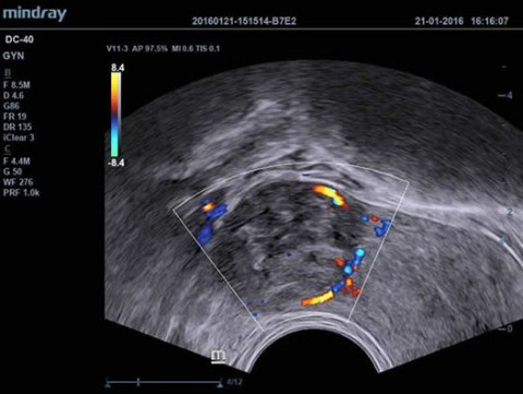 Аппарат ультразвуковой диагностический DC-40 - 415 000 руб.