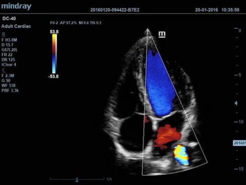 Аппарат ультразвуковой диагностический DC-40 - 415 000 руб.