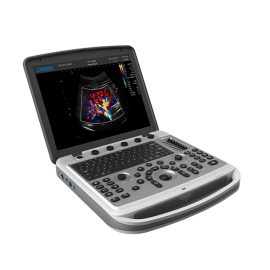 УЗИ аппарат Chison SonoTouch 80 (SonoBook 6)