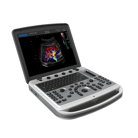 УЗИ аппарат Chison SonoTouch 80 (SonoBook 6) - 0 руб.
