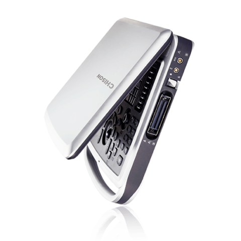 УЗИ аппарат Chison SonoTouch 80 (SonoBook 9) - 0 руб.