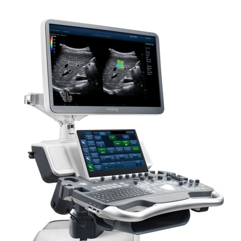 ​Ультразвуковая диагностическая система Mindray DC-80 X-Insight​ - 1 510 200 руб.