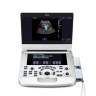 УЗИ аппарат Edan Acclarix AX3 - 702 518 руб.