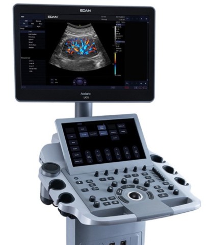 УЗИ аппарат Edan Acclarix LX25 - 986 640 руб.