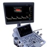 УЗИ аппарат Edan Acclarix LX9 - 2 248 058 руб.