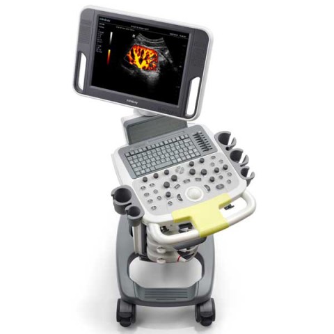 УЗИ сканер Mindray DC-N3 - 332 000 руб.