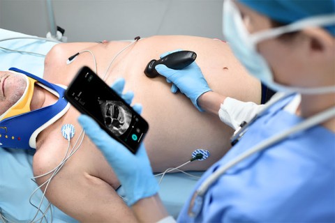 УЗИ сканер Mindray TE Air i3P - 349 500 руб.