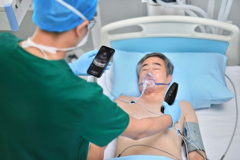 УЗИ сканер Mindray TE Air i3P - 349 500 руб.