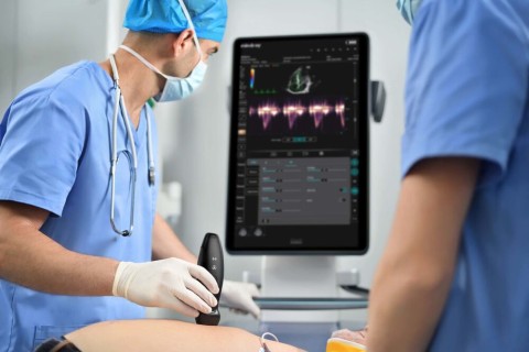 УЗИ сканер Mindray TE Air i3P - 349 500 руб.