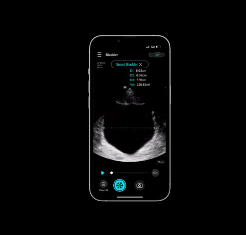 УЗИ сканер Mindray TE Air i3P - 349 500 руб.