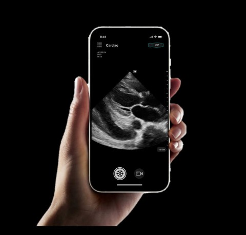 УЗИ сканер Mindray TE Air i3P - 349 500 руб.