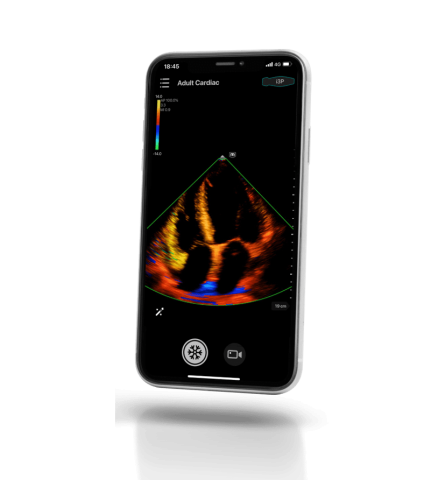 УЗИ сканер Mindray TE Air i3P - 349 500 руб.