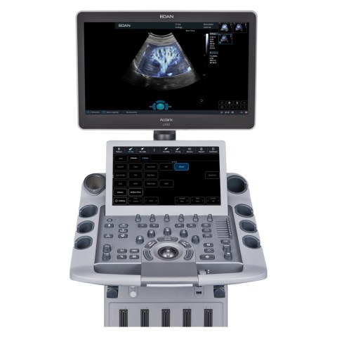 УЗИ аппарат Edan Acclarix LX85 - 1 319 000 руб.